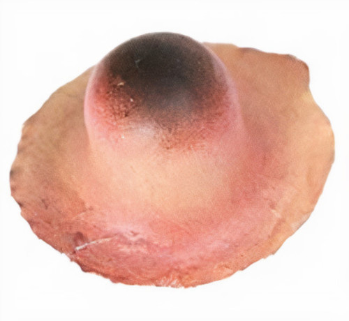 Witbaard čarodejnícka bradavica 2,5 cm latex